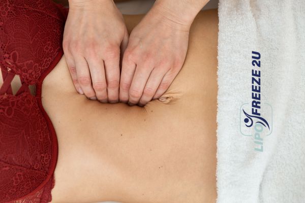 diastasis recti treatment Chinnor