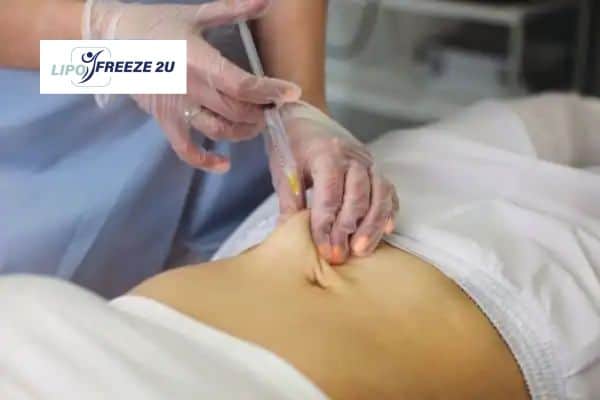 How Does Aqualyx Fat Dissolving Injection Work to Break Down Fat Chinnor?