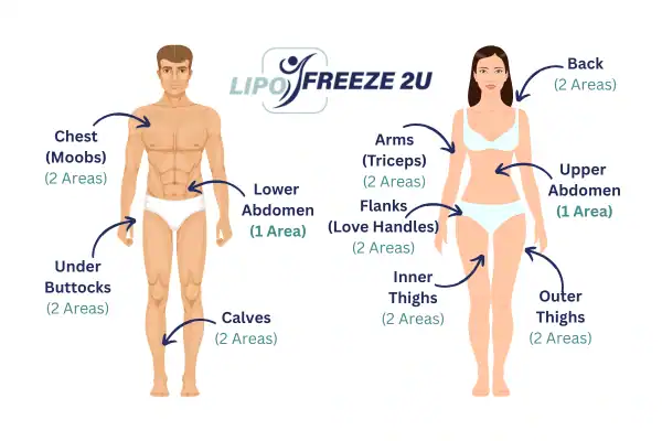 Areas you can have fat freezing treatment Chinnor