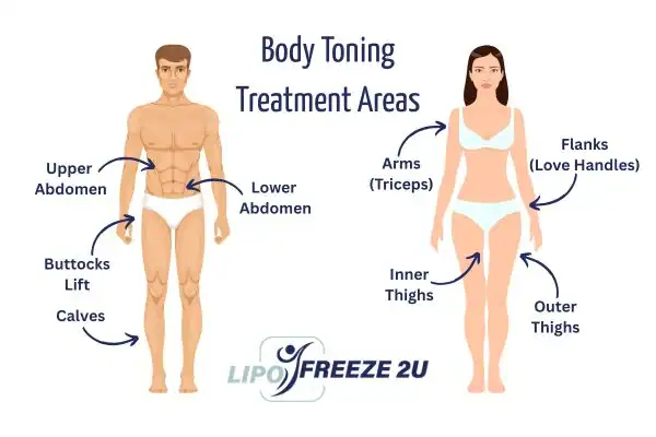 Graphic showing where you can have Body toning Treatment Chinnor on your body