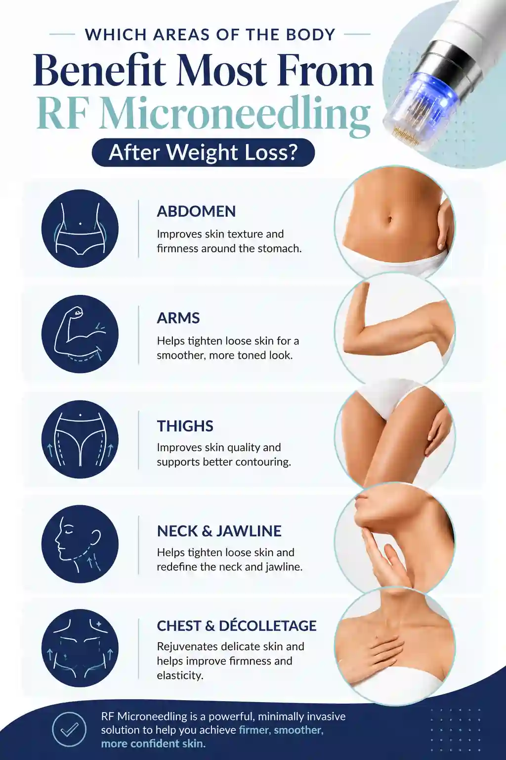Which Areas of the Body Benefit Most From RF Microneedling After Weight Loss Chinnor